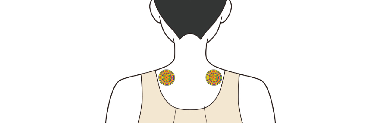首の付け根にRFパッチを貼った例